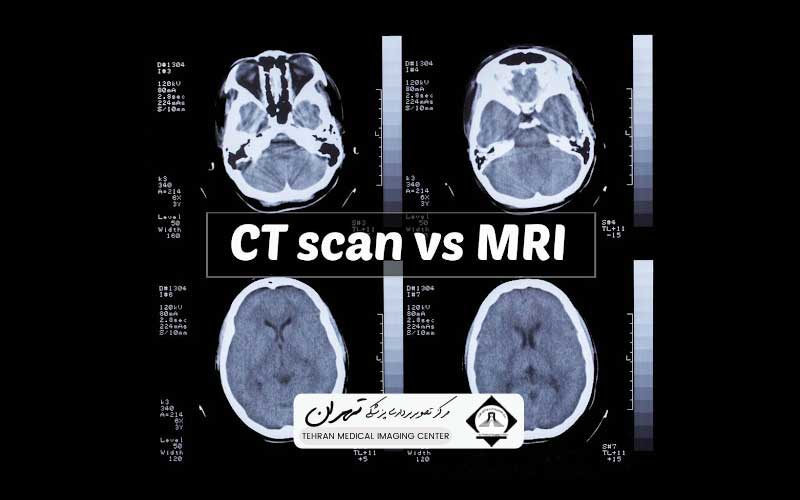 اصول کار سی تی اسکن و ام آر آی