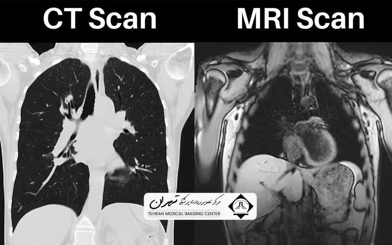 فرق سی تی اسکن و ام آر آی