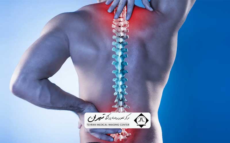 هزینه ام آر آی ستون فقرات