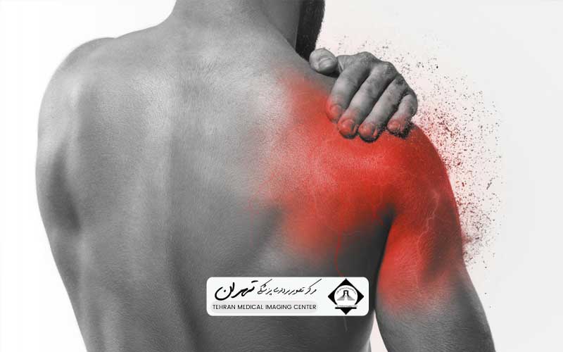 هزینه ام آر آی کتف 8 چرا هزینه ام آر آی کتف در مراکز مختلف متفاوت است؟