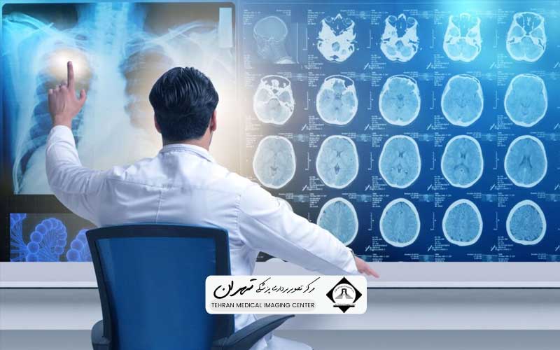 بهترین مرکز ام آر آی تهران 7 اهمیت نوع دستگاه ام آر آی و قدرت میدان مغناطیسی