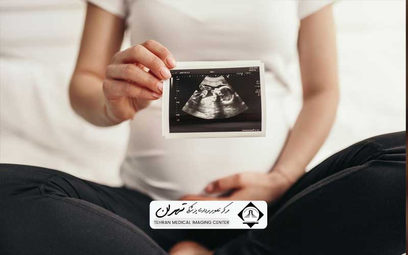 قیمت سونوگرافی بارداری 3 سونوگرافی بارداری چیست و چرا ضروری است؟