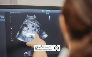 قیمت سونوگرافی بارداری
