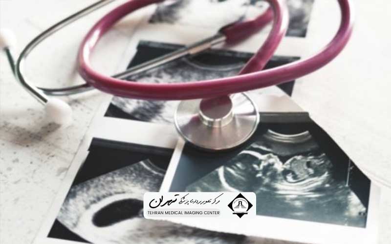 بهترین زمان برای سونوگرافی تعیین جنسیت