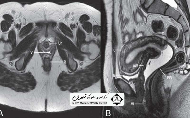 ام آر آی لگن