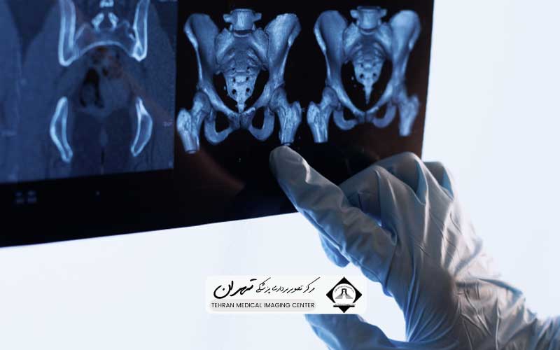 ام آر آی کمر و لگن