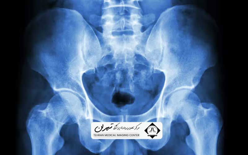 هزینه ام آر آی لگن و شکم 3 تصویربرداری بر هزینه ام آر آی لگن و شکم