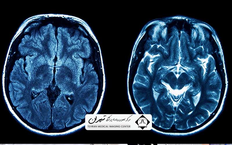 هزینه ام آر آی سر 3 تعیین هزینه ام آر آی سر