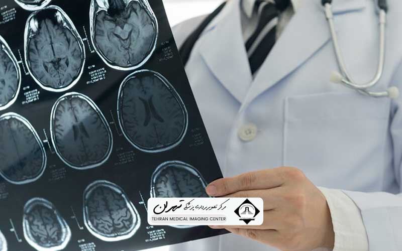 عکس سی تی اسکن مغز سالم 1 عکس سی تی اسکن مغز سالم