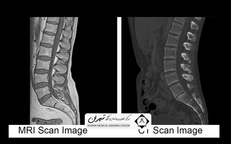 فرق دستگاه سی تی اسکن و ام آر آی