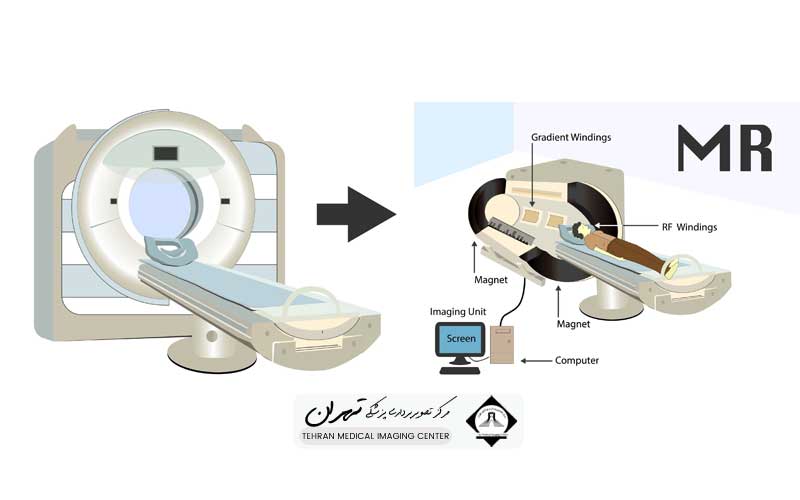 فرق سی تی اسکن و ام آر آی چیست