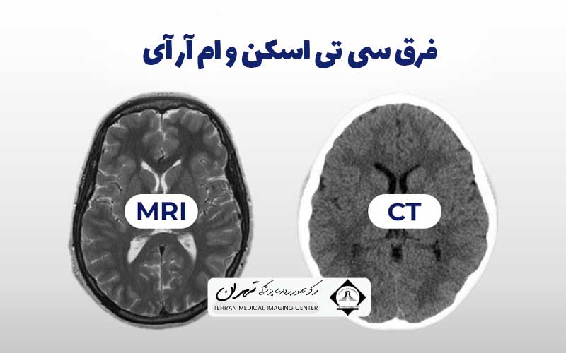 فرق سی تی اسکن و ام آر آی 2 فرق سی تی اسکن و ام آر آی