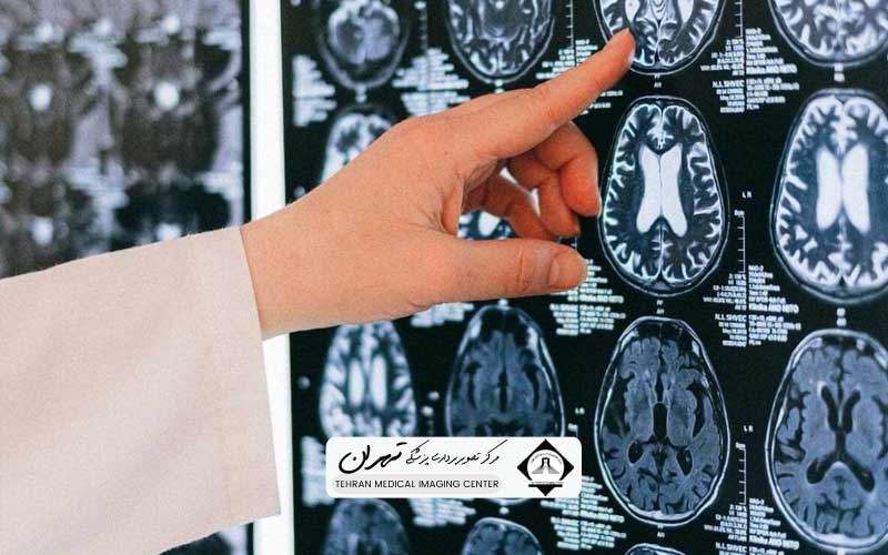 هزینه ام آر آی با دفترچه تامین اجتماعی 1403